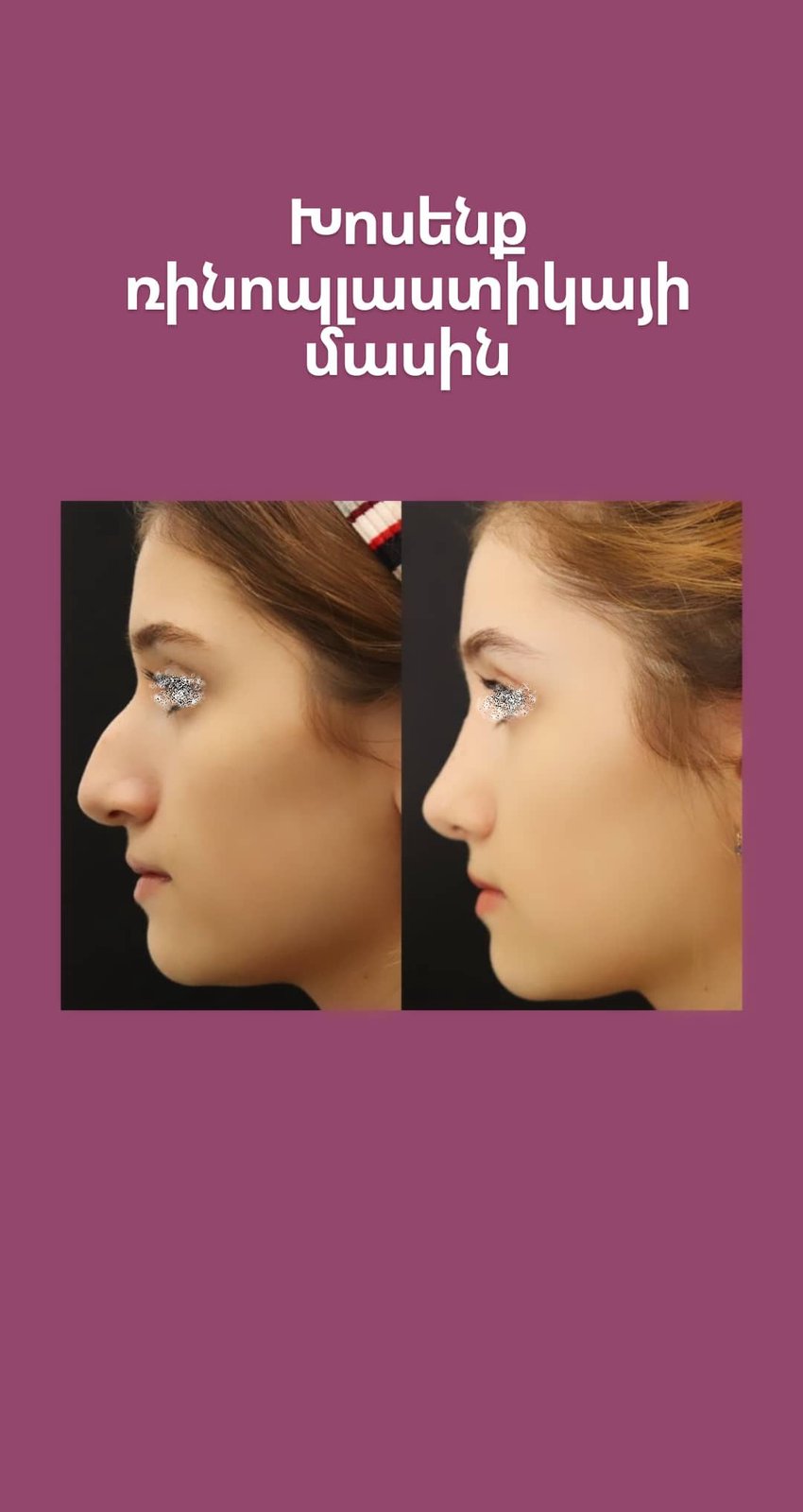 Simillar Post Cover Image 5